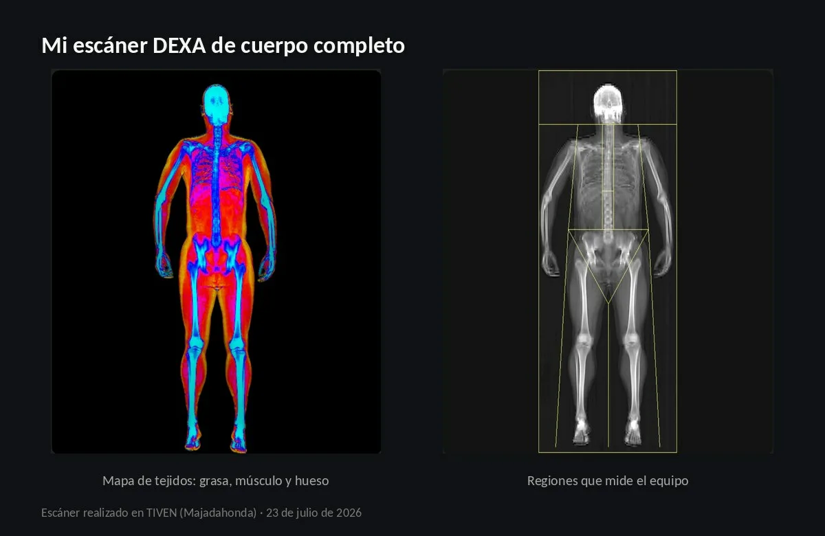 Las dos imágenes de mi escáner DEXA de cuerpo completo: el mapa de tejidos en color y la vista ósea con las regiones que mide el equipo